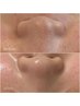 【うる艶肌特化】艶肌チャージWax＋肌荒れ・乾燥・赤み改善艶玉パック90分