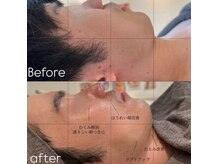 メンズエムボーテ 太田店(Men's M BEAUTE33)の雰囲気(【太田市/顔筋小顔コルギ】人気メニュー)