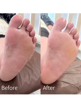 エン(en.)の写真/角質ケア/甘皮ケア/スクラブ/トリートメントケアも充実。豊富な知識で爪の悩みを改善し理想のお手元へ。