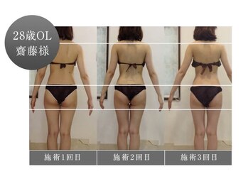 舒苑の写真/夏のむくみ・疲れをスッキリ♪理想のボディラインへ