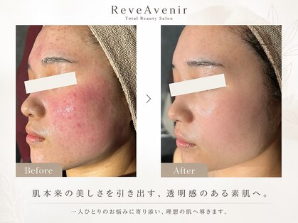 レーヴ アヴニール(Reve Avenir)の写真