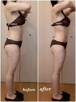 アンフィニ(infini)/短期集中コース7回目(2ヶ月)