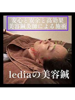 ルディア 堂島店(ledia)/大阪美容鍼灸 全員国家資格保有