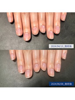 ブラン(blanc)/19.自爪育成