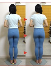 渋谷キュア整体ルーム/X脚と同時に実は、肋骨も美尻も