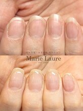 マリーロール 梅田店(Marie Laure)/深爪矯正/自爪育成/自爪風