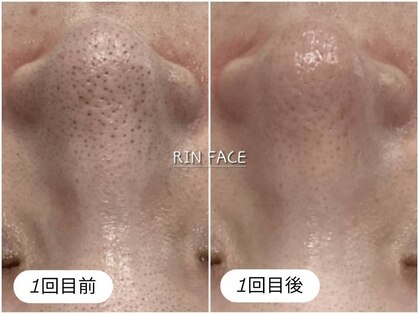 リンフェイス 銀座店(RIN FACE)の写真