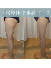 レイアス(Ray as)/太もも前張りがなくなりました♪