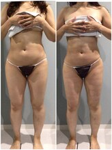 fallon beauty　痩身/フェイシャル/フェム・オムケア/アロマ/ボディケア/痩身キャビMAX