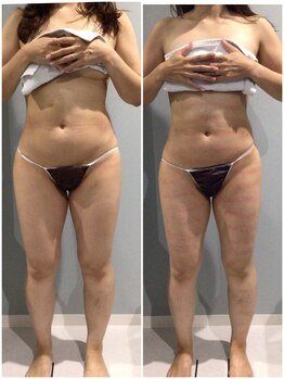 fallon beauty　痩身/フェイシャル/フェム・オムケア/アロマ/ボディケア/痩身キャビMAX