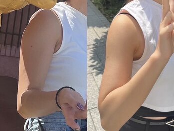 ヨサパーク ベル(YOSA PARK Belle)/二の腕もしっかり！