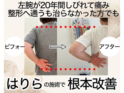 鍼灸院はりらの写真