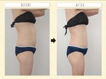 エステアンドトレーニング ビビ(ViVi)/お腹