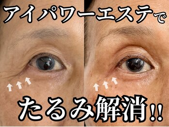 モンステラ(MONSTERA)の写真/完全貸切だから、じっくり自分と向き合える。アイパワーエステで目元の土台ケアができる大人女性向けサロン