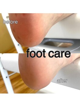 リーシュ 所沢店(RICHE)/フット角質ケア