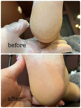 カラン(KARAN)/カサカサかかと