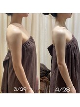 ビュール 銀座(BeauL)/ブライダルエステ