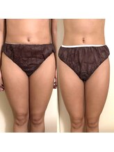 シーアイエステティック 船橋駅前店(c.iエステティック)/EMS 120分&レモンボトル