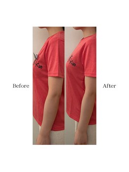 腸もみ堂 春kao/腸もみ施術後の変化