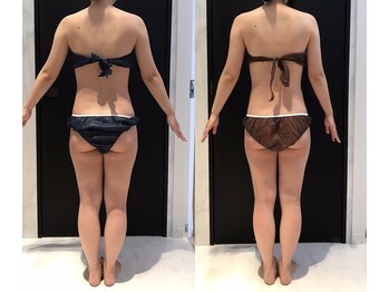 リボディ 表参道(An re Body)/before→after