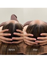 ハートランド(HEARTLAND)/小顔・むくみ改善　1回の施術