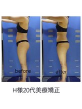 エステージ(estage)/