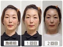 あんじゅみにょん80の雰囲気（その時だけの変化ではなく　セルフケアもお伝えし本来の姿へ）