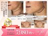 【9月限定】《先着10名》二重あご×ほうれい線ケア専用【切らない熱リフト】