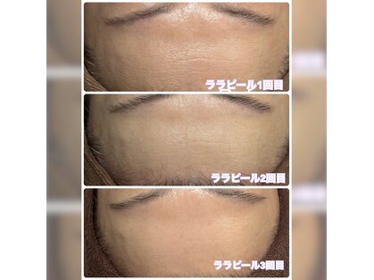 ビュップ 青葉台店(美u・p)の写真