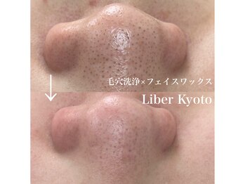 リベルキョウト 京都駅前店(Liber Kyoto)/タマゴ肌コース