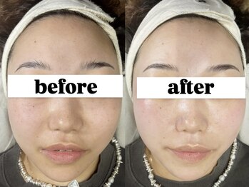 フェディス(Fedis)/ツヤ肌/フェイシャルワックス