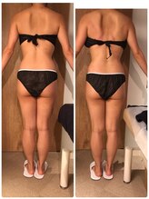 エイジングケアサロン 青山 本店/ビフォア・アフター！