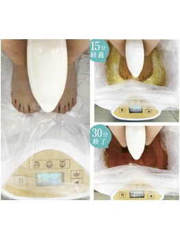 足のむくみを解消したい