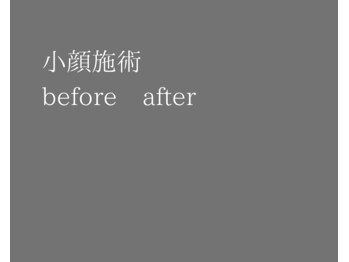 わたしのネイルとよもぎ蒸し/