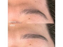 ダン(dan)/【EYEBROW WAX】症例