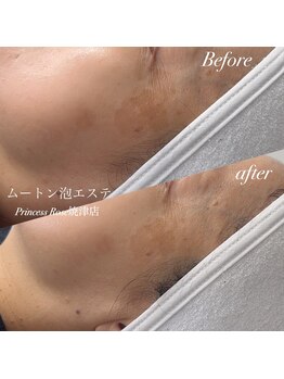 プリンセスローズ 焼津店(Princess Rose)/ムートン泡エステ