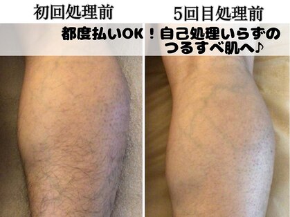 リノリノ(LinoLino)の写真