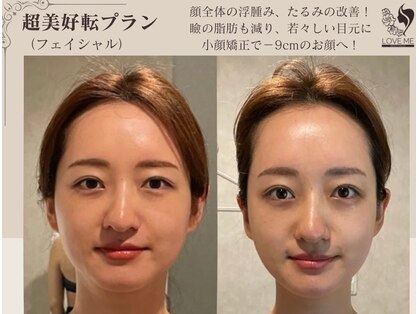 ラブミー 渋谷本店(LoveMe)の写真