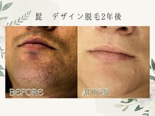 ラフラフ(Laf Laf)