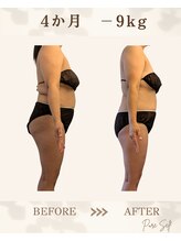 ピュアセルフ 新浦安(Pure Self)/ガンコなお尻もすっきり小さく