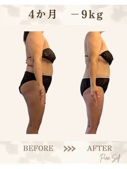 ピュアセルフ 新浦安(Pure Self)/ガンコなお尻もすっきり小さく