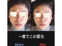 美容矯正サロン レレポノ(LELEPONO)/