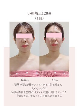 トゥインクル 麻布(twinkle)/南麻布/シンメトリー小顔矯正