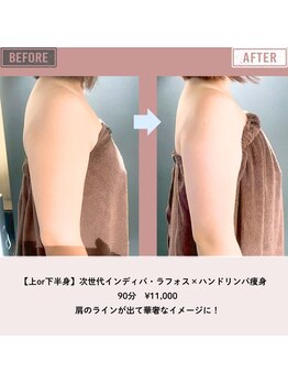 マーリエ(Malie)/【ラフォス】二の腕