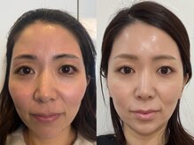 ココ(COCO)の雰囲気（続ける事で蓄積美容★将来の美容貯金◎しみ、くすみ、たるみ）