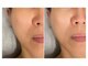 サロンコスメティック ザ スパ(SALON COSMETIC THE SPA)の写真/新メニュー！！
トライアルコースをご用意しております♪