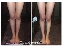 ラネージュミル(La neige mille)/インキュア痩身