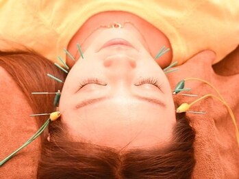 マイアート(My Art)/電気でスッキリ引き締め小顔に★