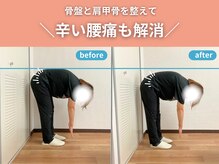 整体院カイト/【腰痛】