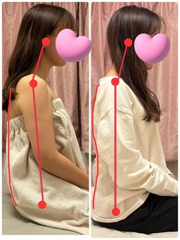 レモンローズ(Lemon Rose)/猫背矯正【大阪猫背矯正】